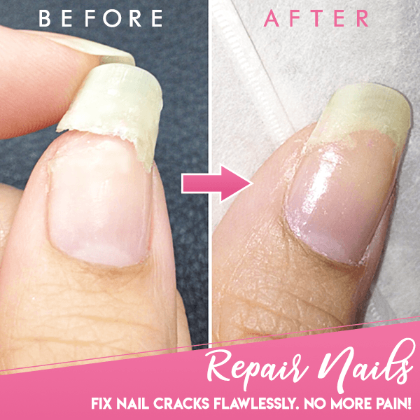 CRACKED NAIL REPAIR GEL